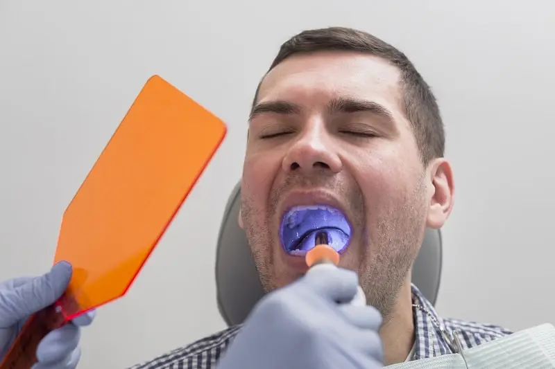 Pros and Cons of Deep Cleaning Teeth