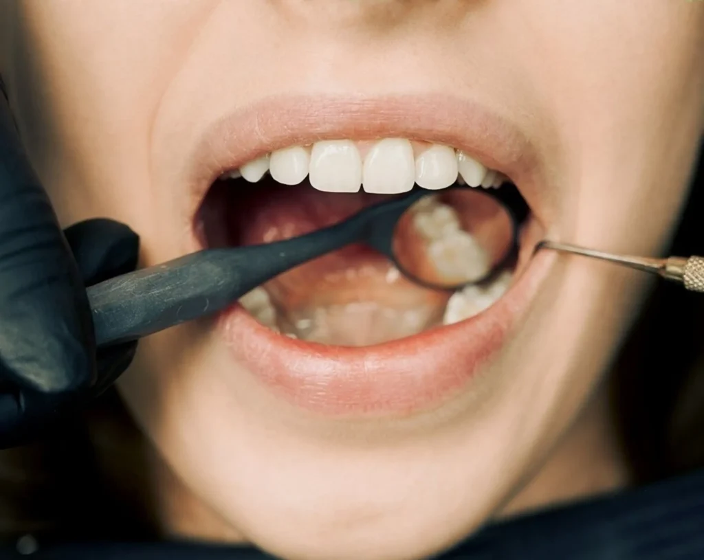 Does Tooth Extraction Hurt