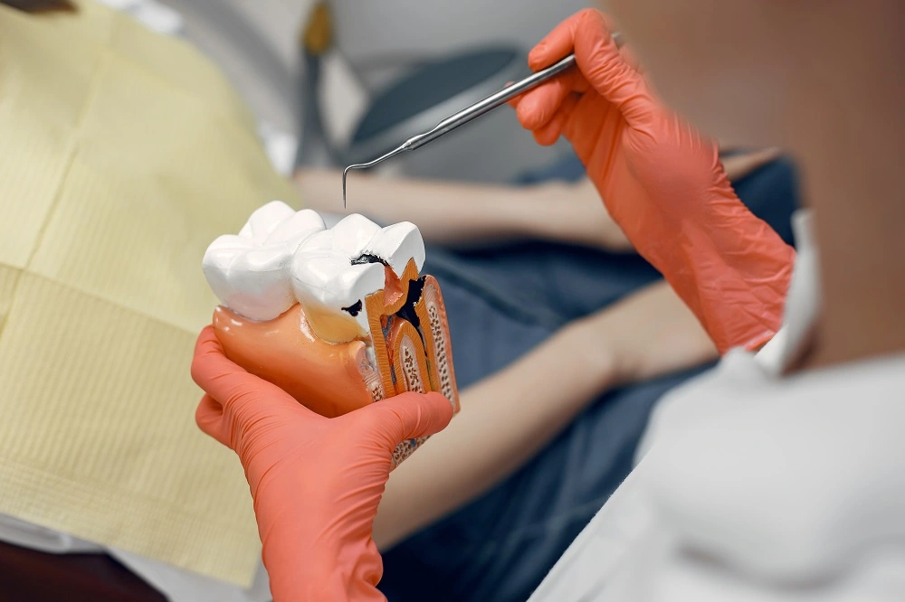 How Long Does It Take For a Cavity to Form