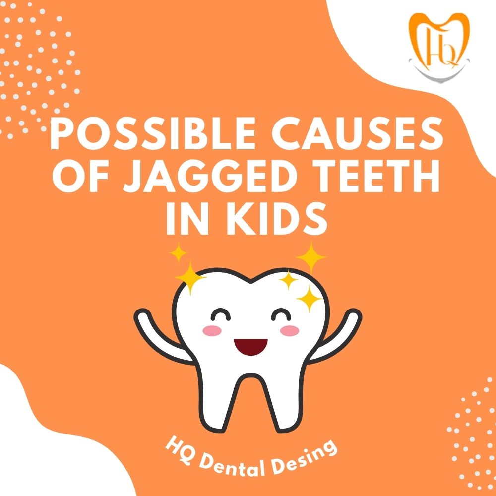 Possible Causes oF Jagged Teeth in Kids