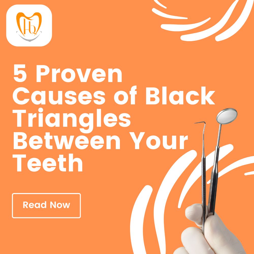 5 Proven Causes of Black Triangles Between Your Teeth