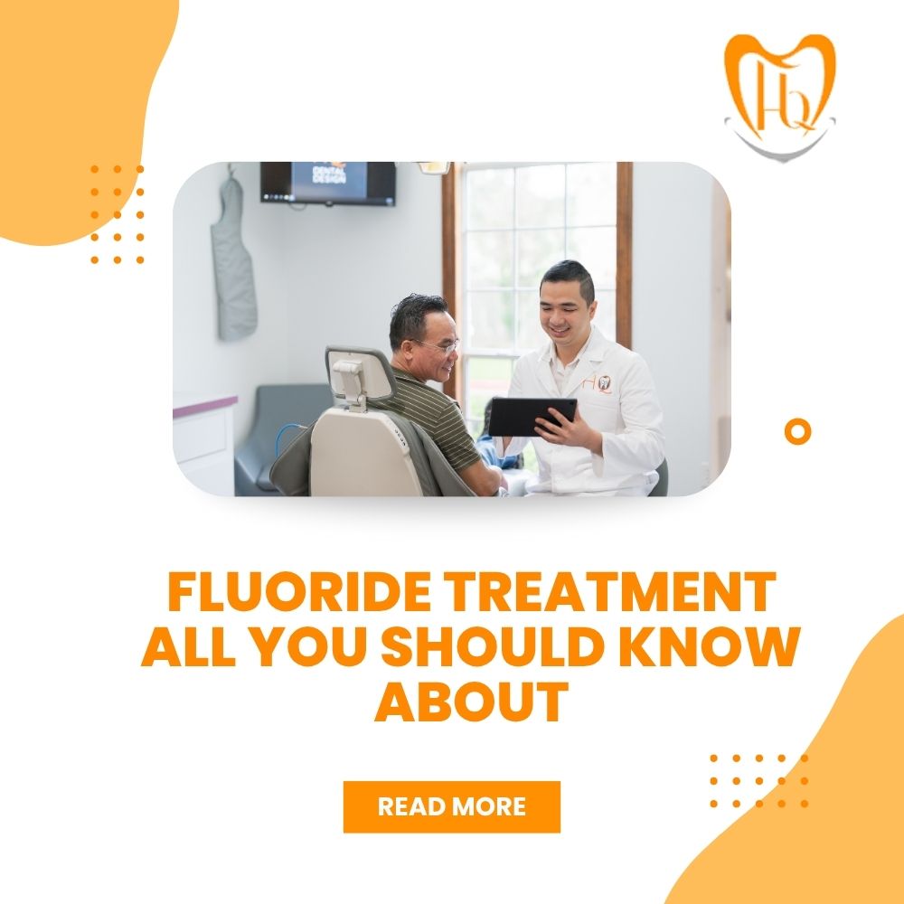 Fluoride Treatment All You Should Know About.