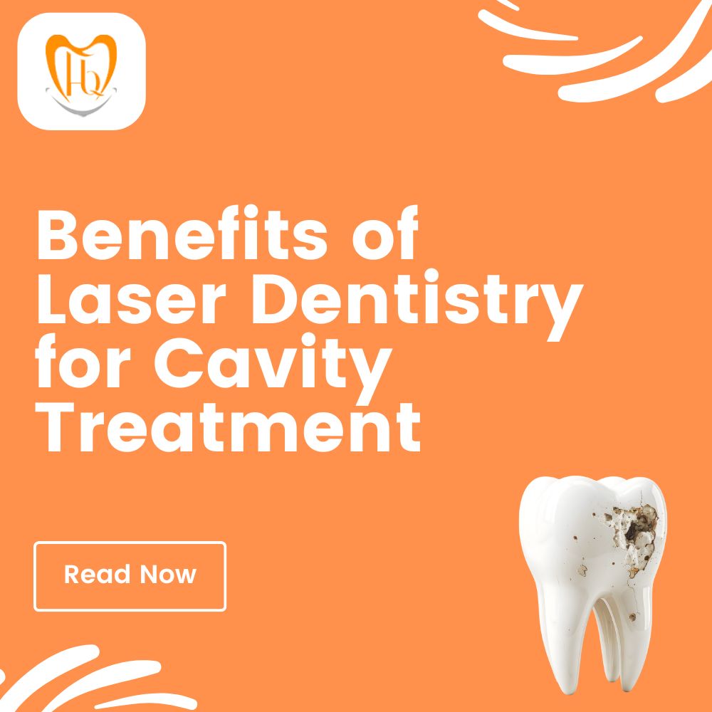 Benefits of Laser Dentistry for Cavity Treatment