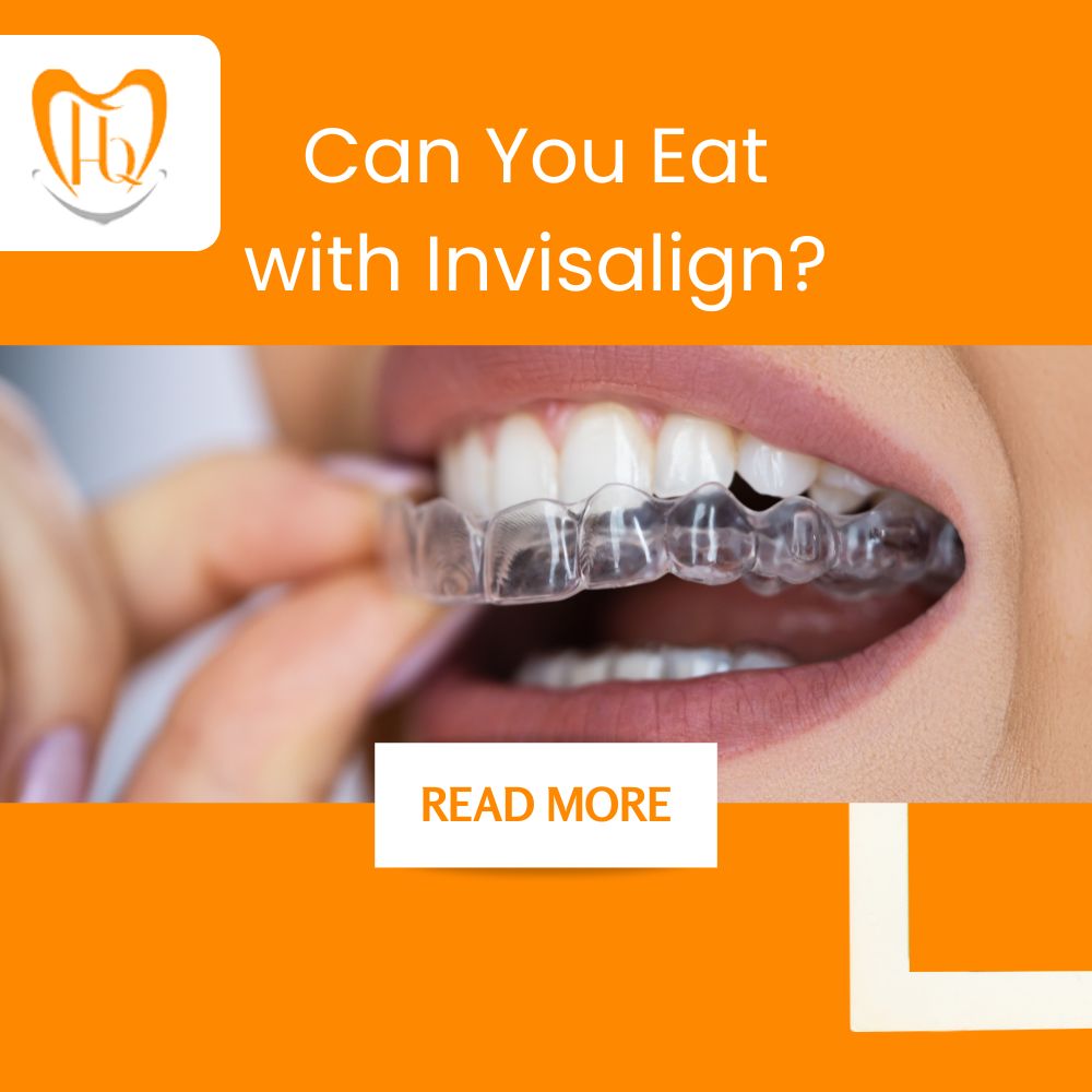 Can You Eat with Invisalign