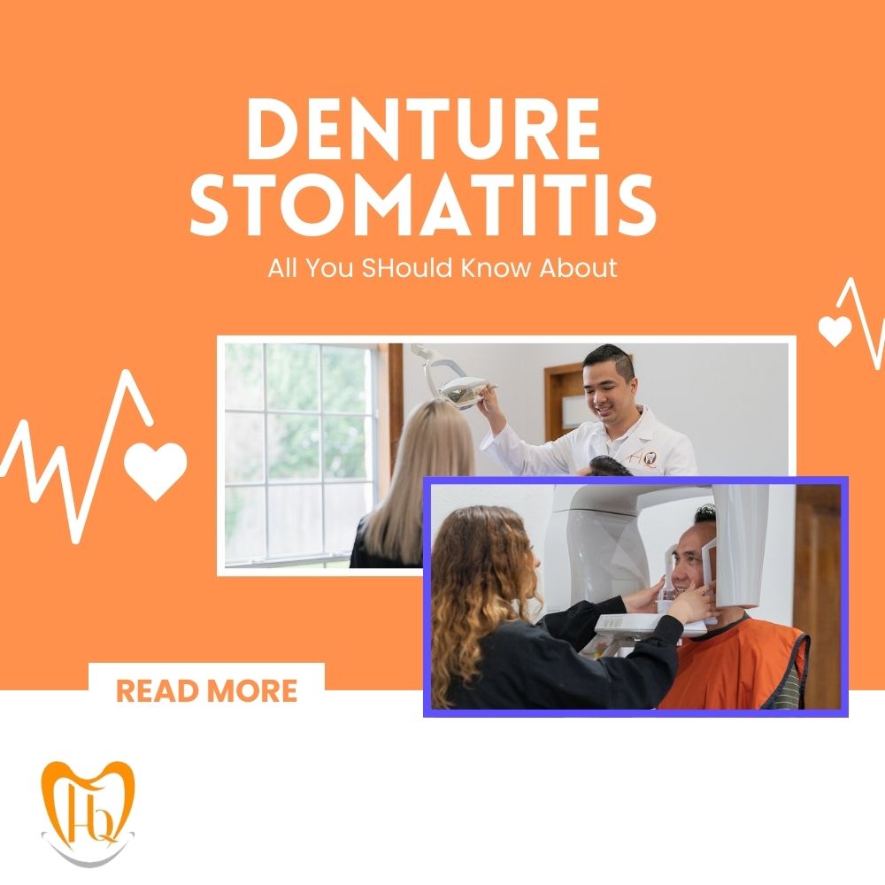 Denture Stomatitis