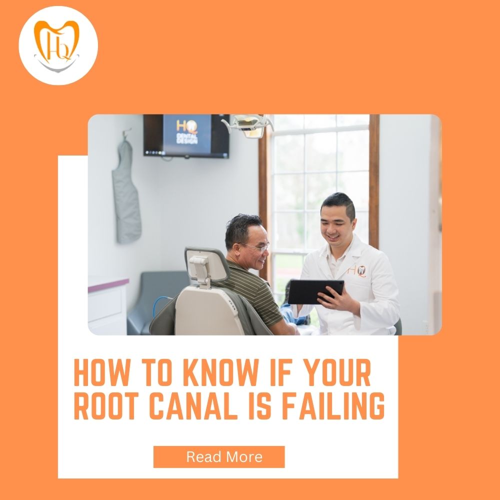 How to Know if Your Root Canal is Failing