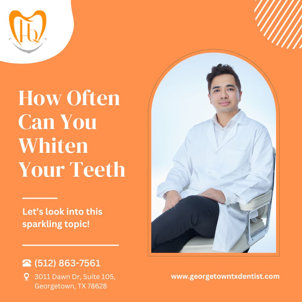 How Often Can You Whiten Your Teeth