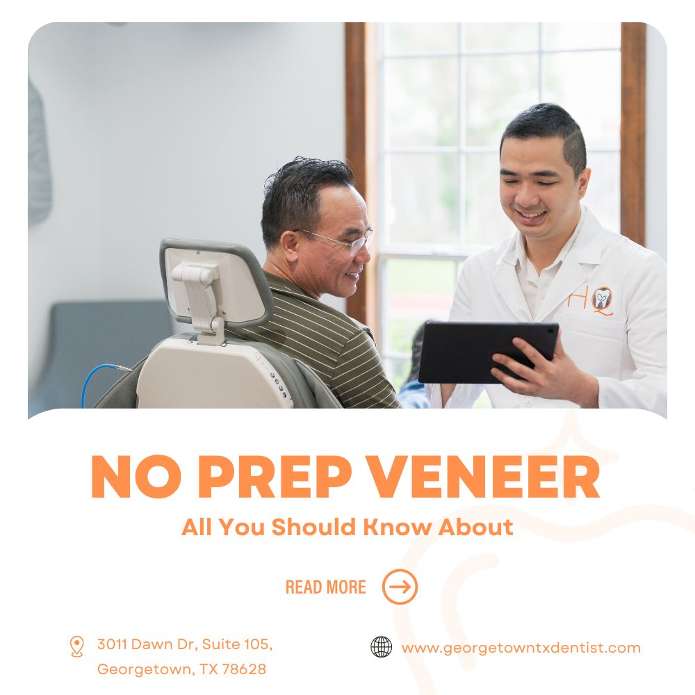 No Prep Veneer: All you should know about