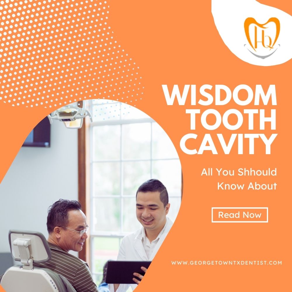 Wisdom Tooth Cavity
