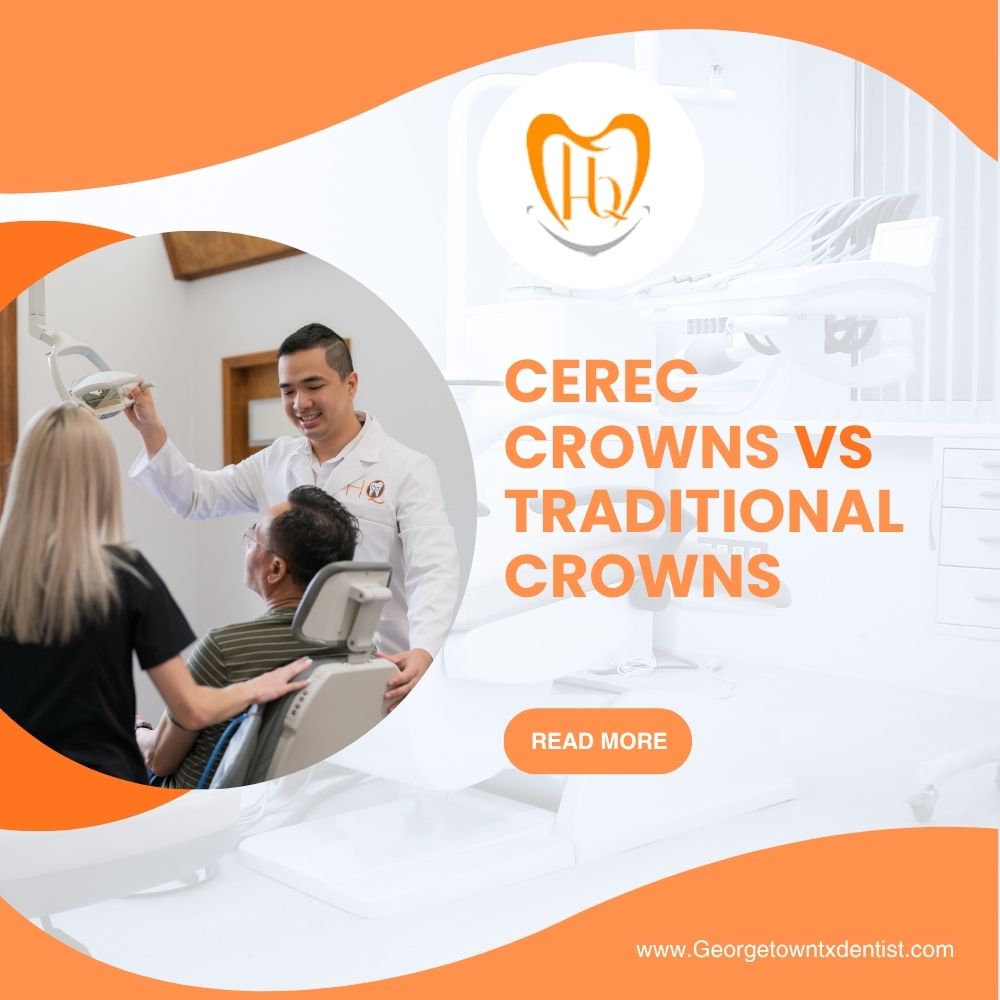 CEREC Crowns vs Traditional Crown