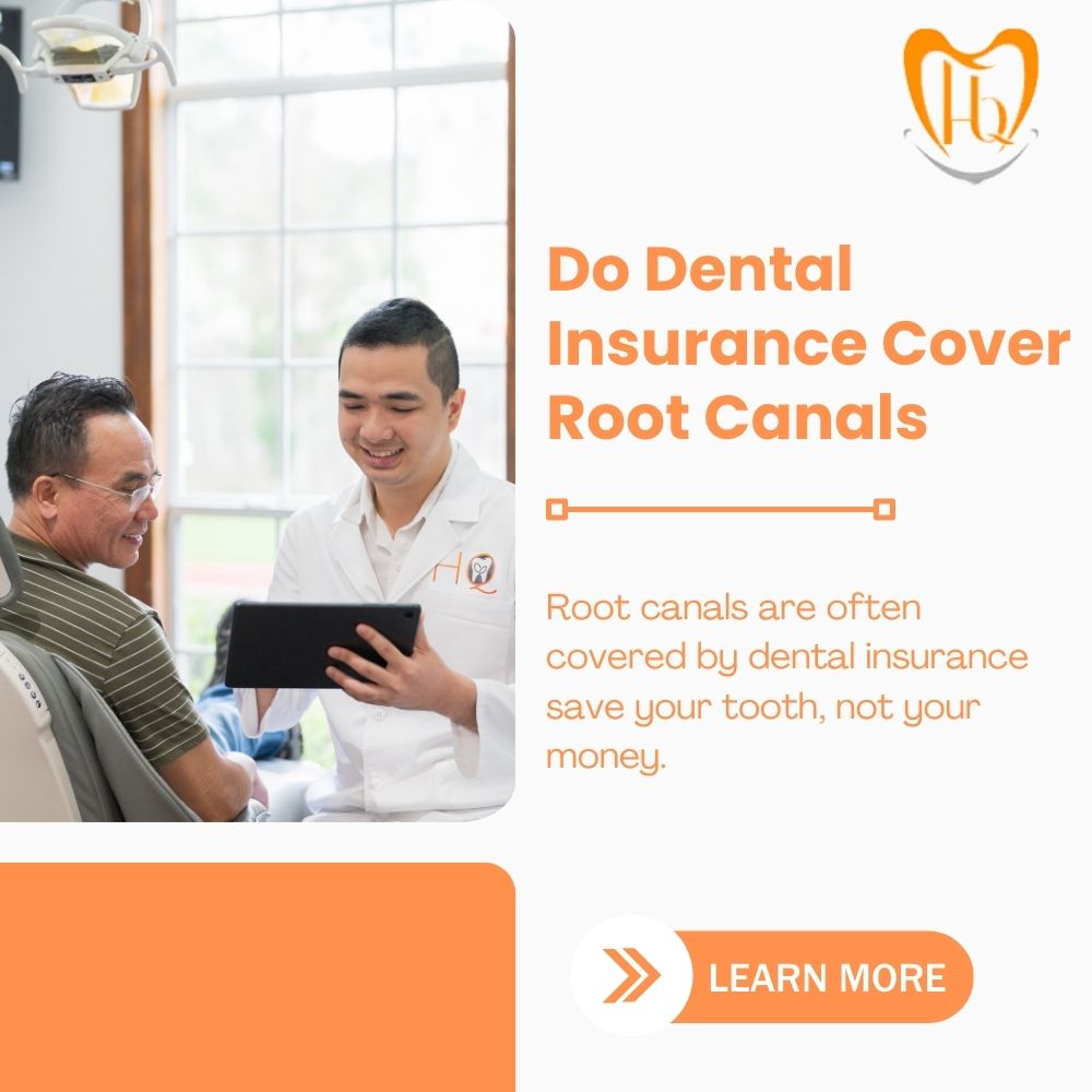 Do Dental Insurance Cover Root Canals