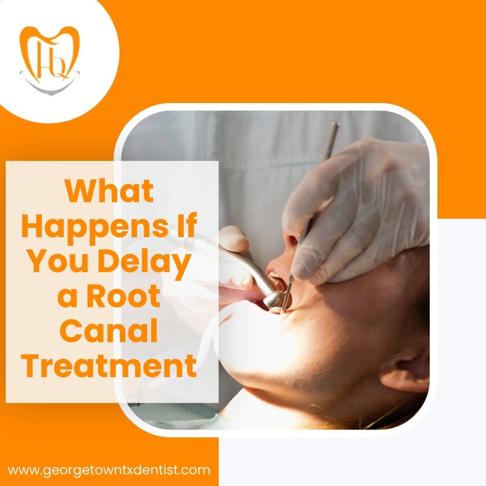 What Happens If You Delay a Root Canal Treatment