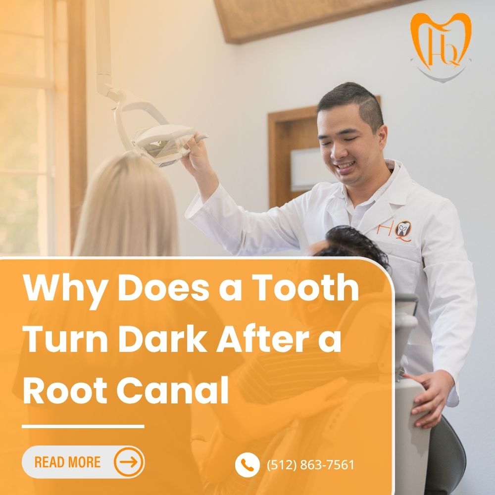 Why Does a Tooth Turn Dark After a Root Canal