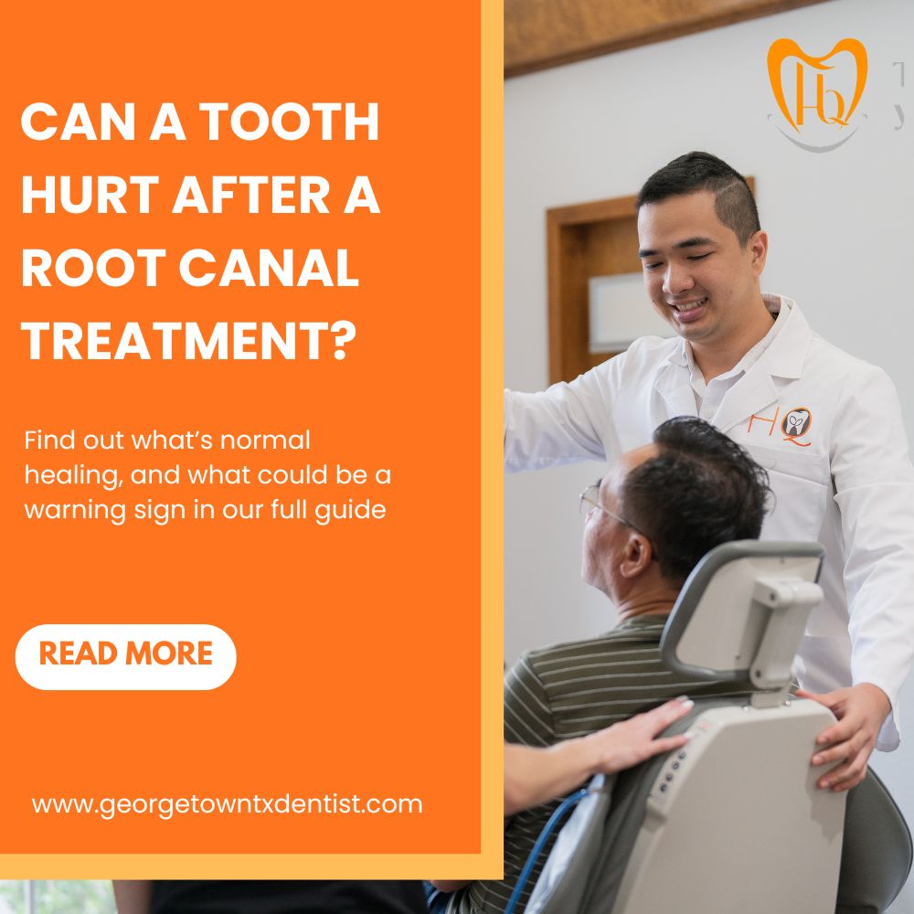 Can a Tooth Hurt After a Root Canal Treatment